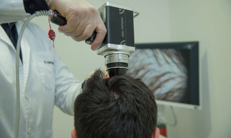 Especialistas en el tratamiento de la foliculitis decalvante en Madrid - Clínicas en Calle Cinca y La Moraleja. Especialistas en el tratamiento de la foliculitis decalvante en Madrid - Clínicas en Calle Cinca y La Moraleja.