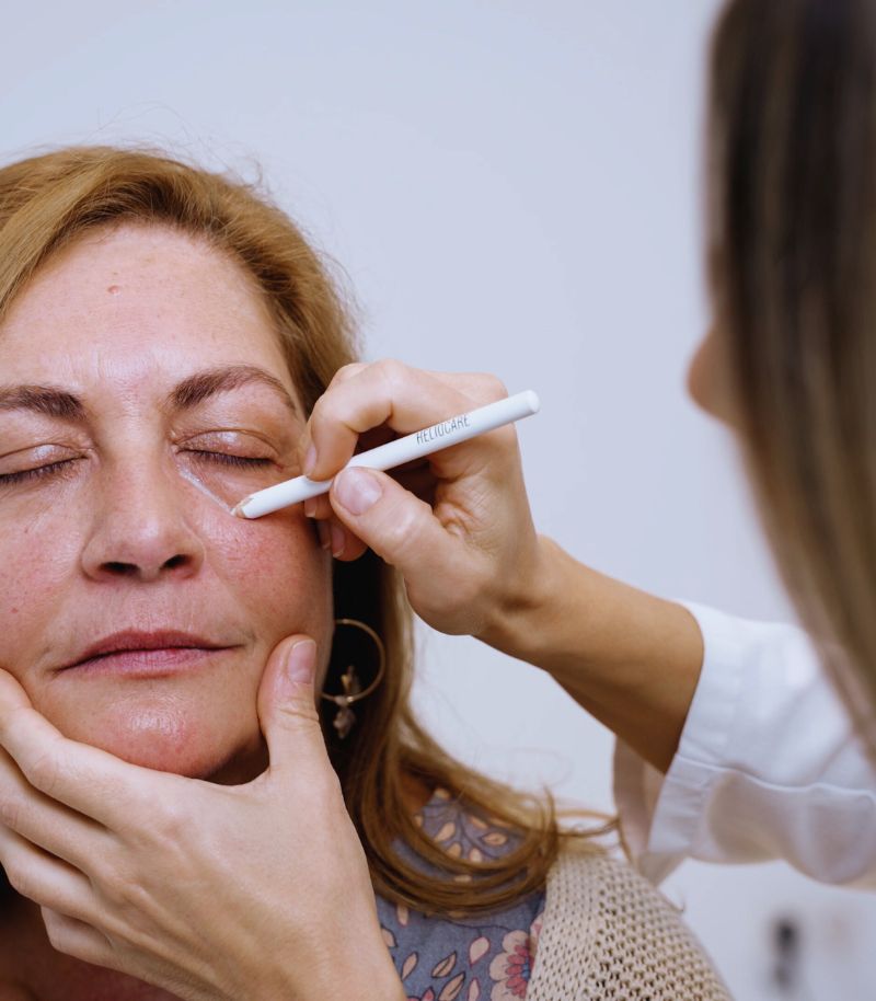 Combinación de técnicas para rejuvenecer el tercio superior de forma integral Combinación de técnicas para rejuvenecer el tercio superior de forma integral