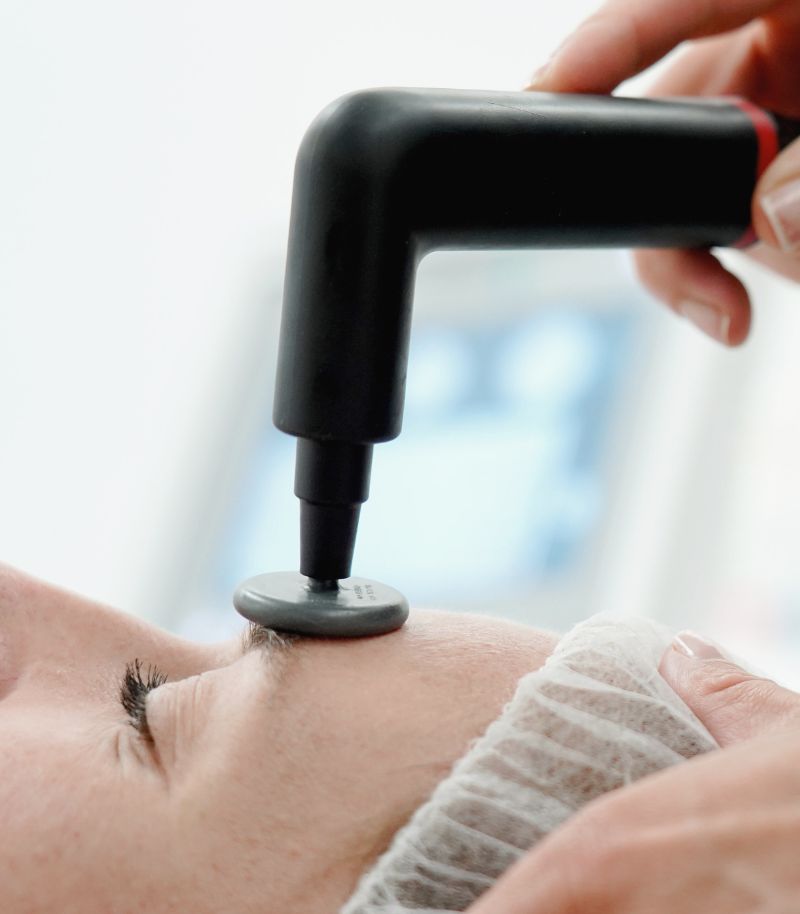 Radiofrecuencia facial Radiofrecuencia facial