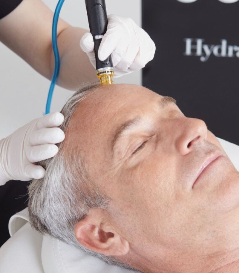 Terapia hydrafacial capilar Terapia hydrafacial capilar