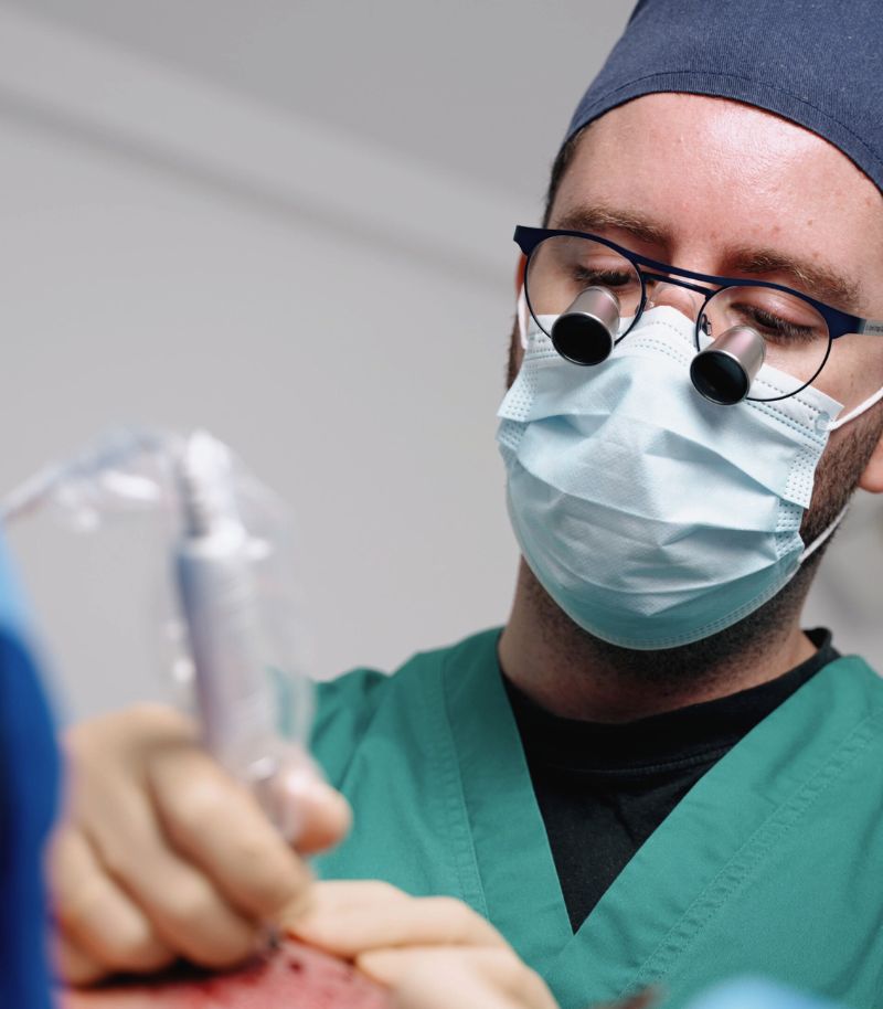 Especialistas en casos complejos de trasplante capilar con técnica FUE sin rapar
