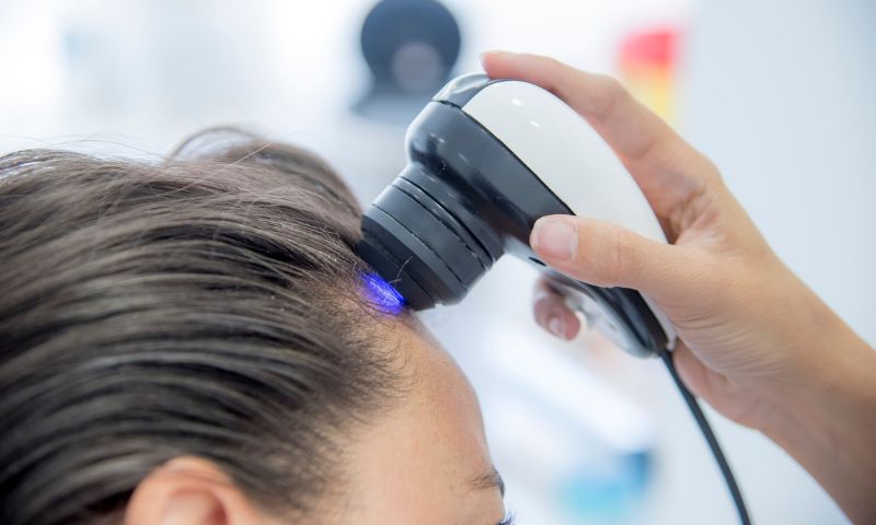 Tricólogos especialistas en el tratamiento de la alopecia femenina en Madrid (Calle Serrano y La Moraleja).