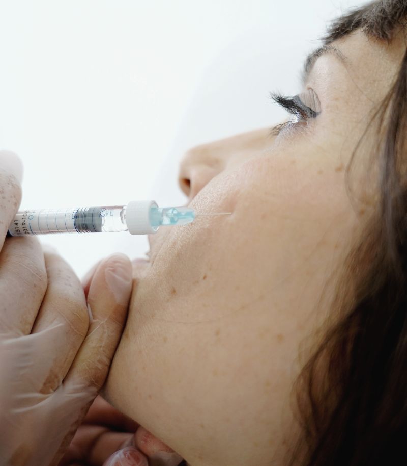 La armonización de pómulos con técnica médica inyectada puede ser una alternativa a la cirugía