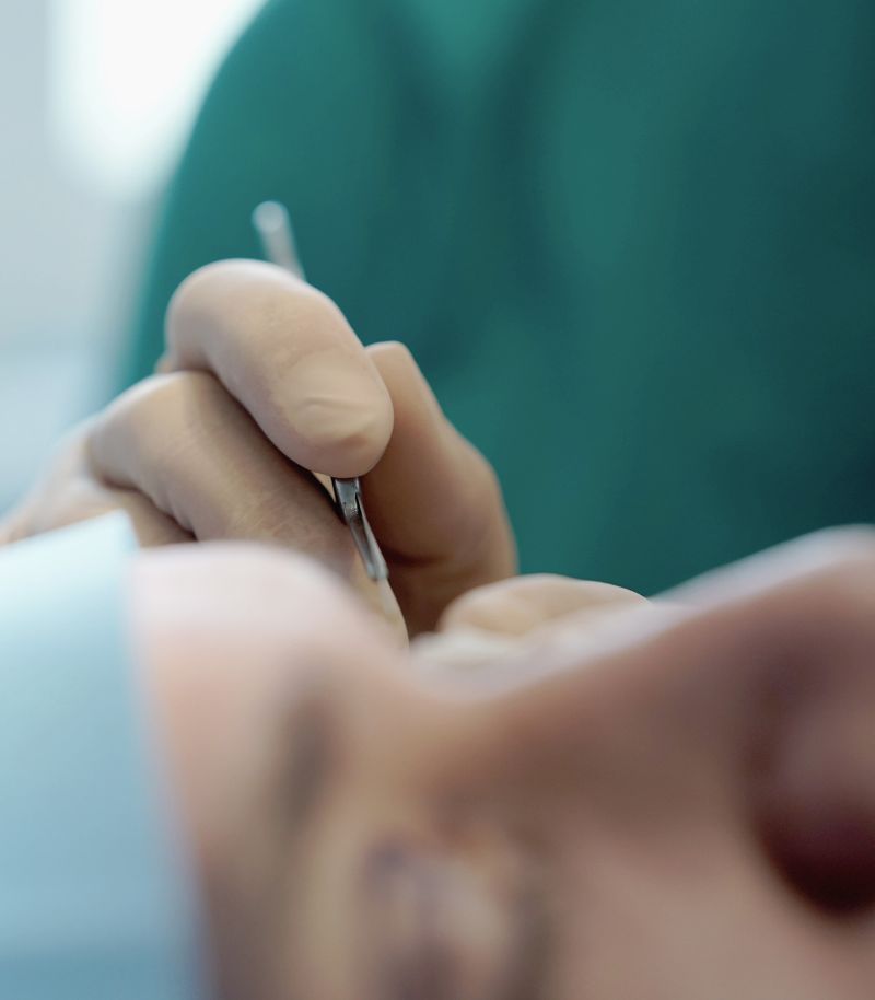 Cirugía de párpados para rejuvenecer la mirada con precisión y mínima cicatriz Cirugía de párpados para rejuvenecer la mirada con precisión y mínima cicatriz
