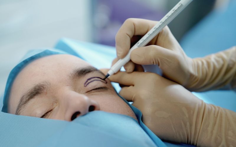 Cirujanos especialistas en blefaroplastia en Madrid - Clínicas en Calle Serrano y La Moraleja.