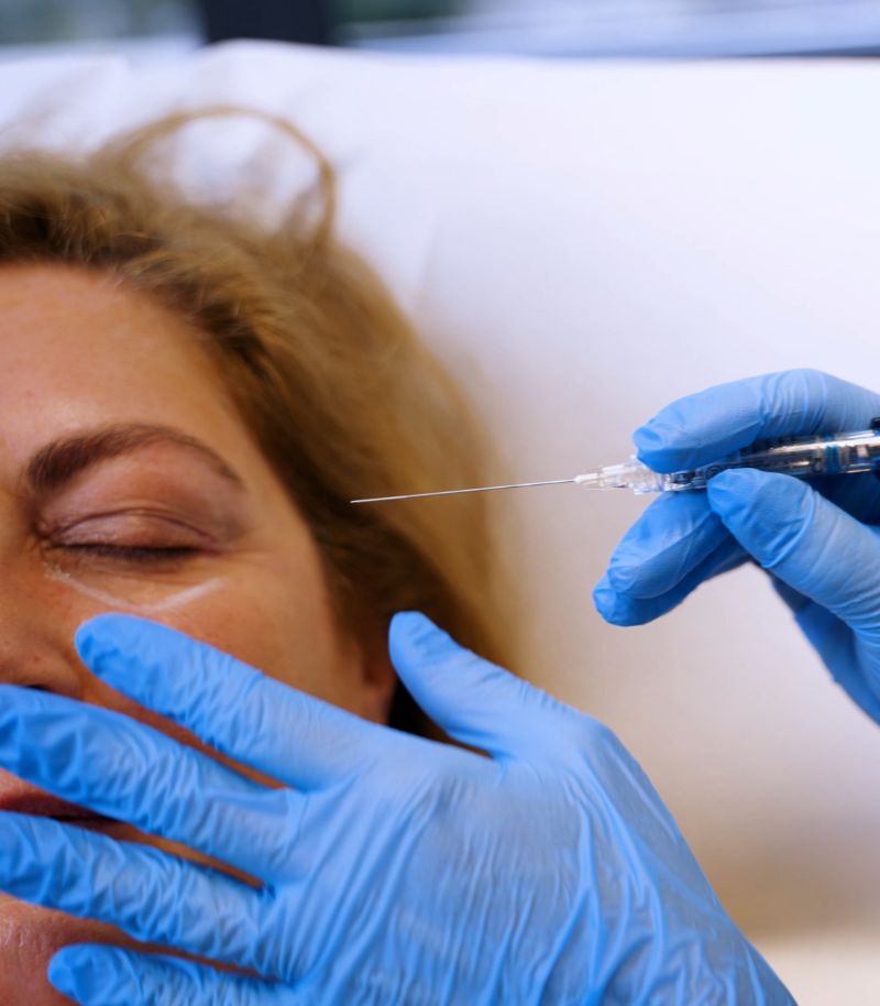 Rinomodelación para corregir defectos tras rinoplastias quirúrgicas previas