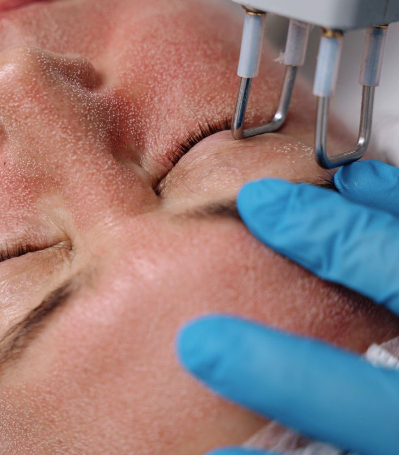 Tratamientos preventivos para retrasar el envejecimiento facial desde etapas tempranas Tratamientos preventivos para retrasar el envejecimiento facial desde etapas tempranas