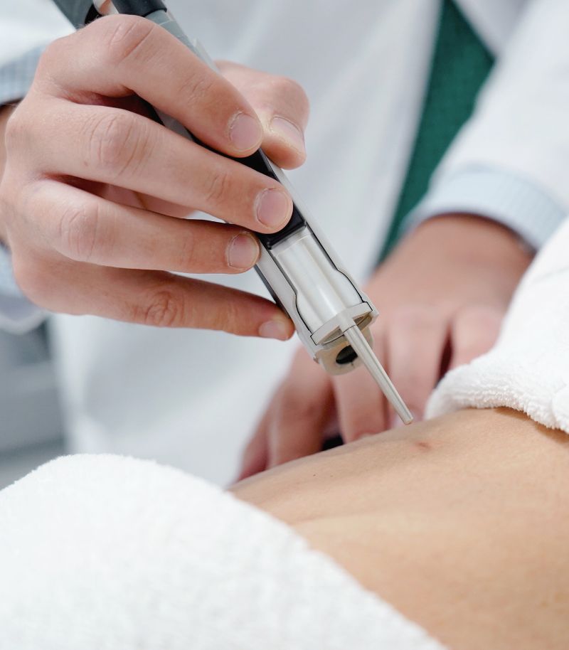 Protocolo médico estético a los 3 meses de dar a luz