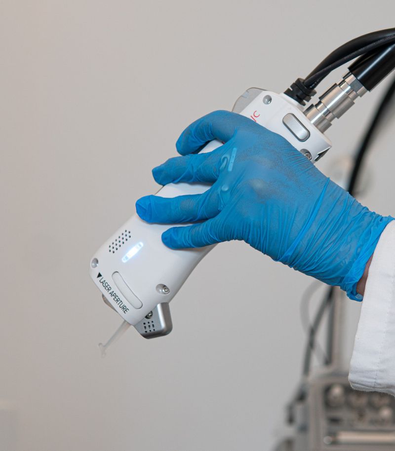 Láser DermaV para rosácea, telangiectasias y lesiones vasculares Láser DermaV para rosácea, telangiectasias y lesiones vasculares