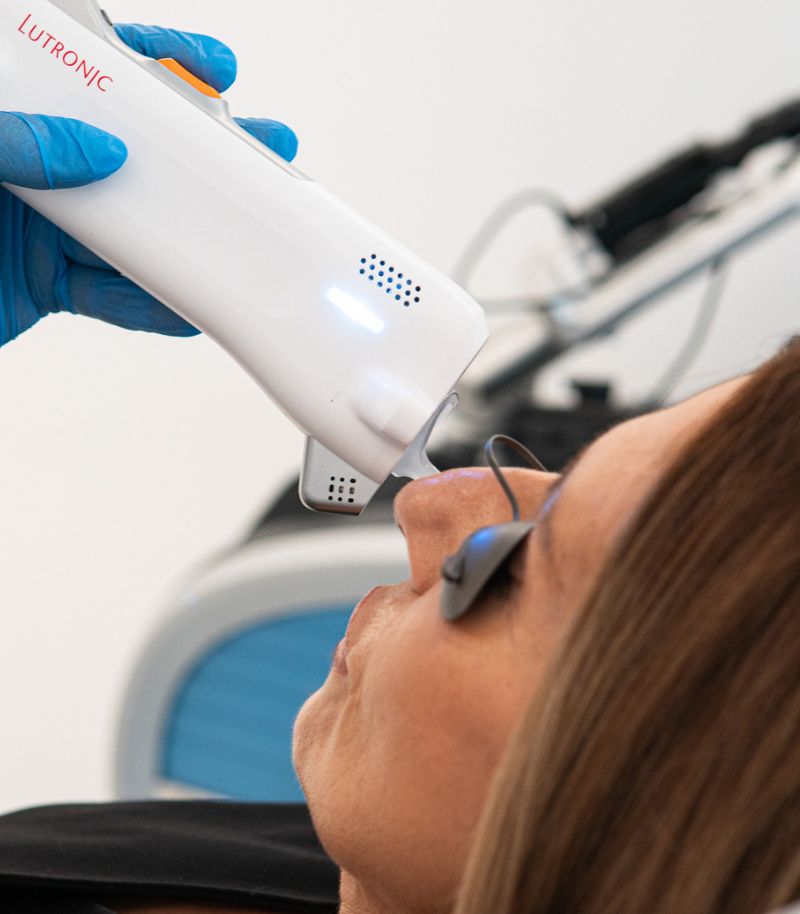 Tratamiento con láser DermaV mediante barridos homogéneos sobre la piel Tratamiento con láser DermaV mediante barridos homogéneos sobre la piel