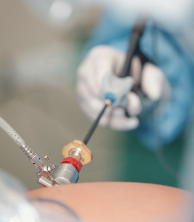 Laparoscopia en cirugía reproductiva Laparoscopia para tratar alteraciones del aparato reproductor que pueden afectar a la fertilidad