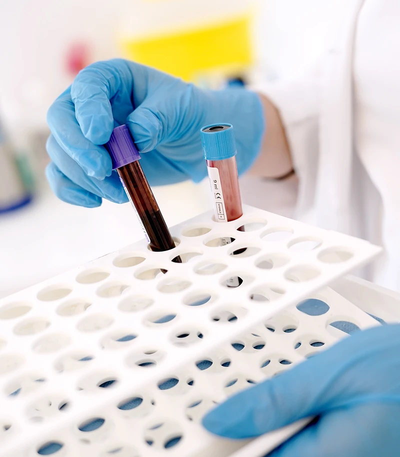 Estudio de la microbiota en la salud del hombre Estudio de la microbiota en la salud del hombre