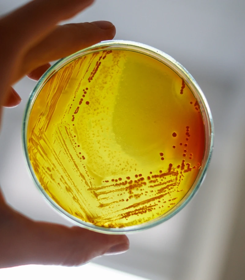 Microbiota, metabolismo y riesgo cardiovascular Microbiota, metabolismo y riesgo cardiovascular